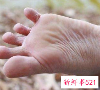 冬天脚出汗多是什么原因