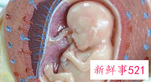 胎盘钙化有哪些危害