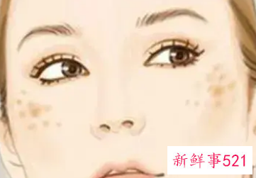 黄褐斑和晒斑的区别在哪里