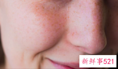 我的斑点都变淡散开了