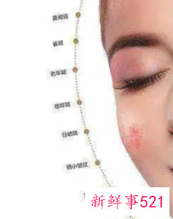 脸发热发红发痒怎么快速缓解