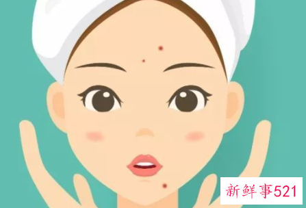 油性皮肤痘痘肌怎么调理