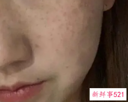 我的斑点都变淡散开了