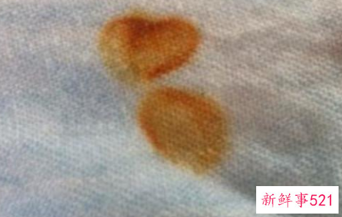 祛除铁锈的方法