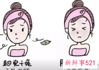 冬天皮肤干燥怎么保养皮肤