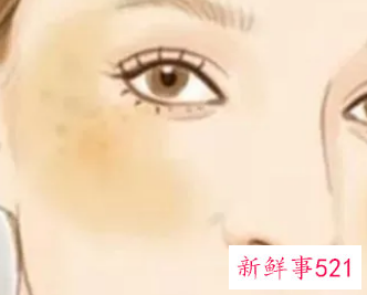 黄褐斑和晒斑的区别在哪里