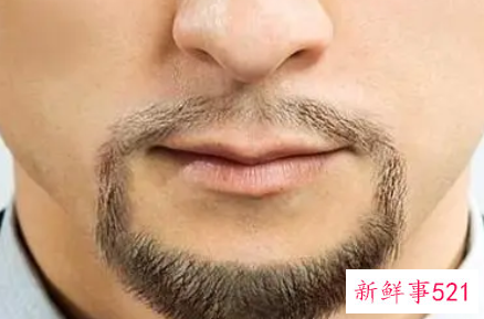 男士的脸两边的胡子怎样永久去除