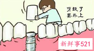 种牙术后需要注意什么