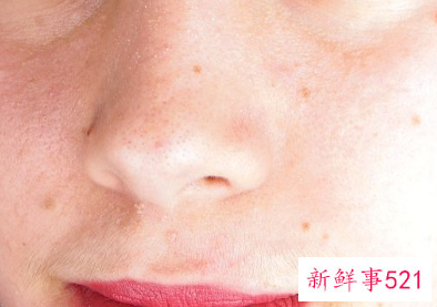 斑怎么才能慢慢淡化