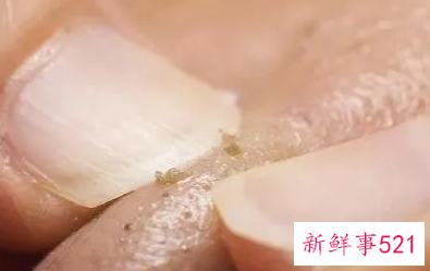 养颜护肤妙方有哪些