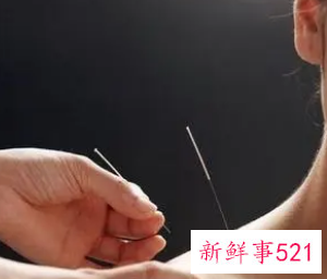 女人针灸的禁忌