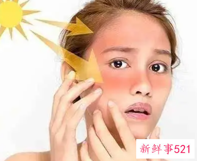 敏感肌肤怎么保养皮肤