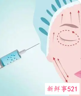 脂肪填充一年后后遗症