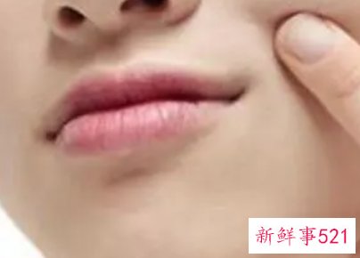 如何预防嘴周围皱纹