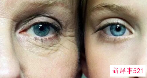 女性各年龄段出现的面部皱纹