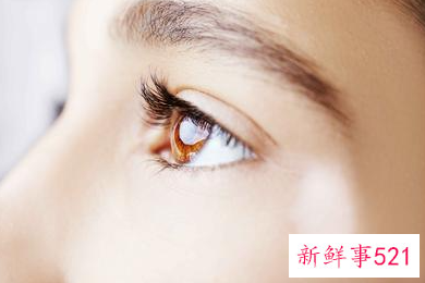 多吃什么对眼睛好