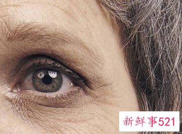 女性各年龄段出现的面部皱纹