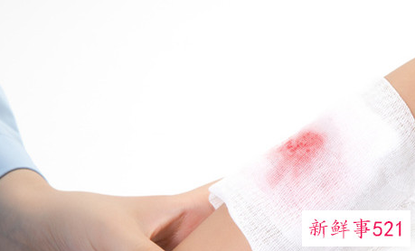 梦见摔伤有什么征兆