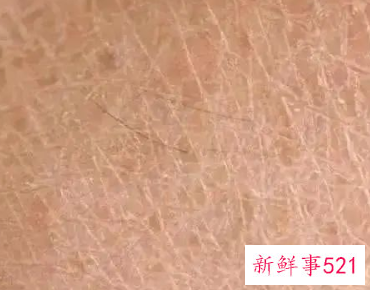 面部抗衰活动主题