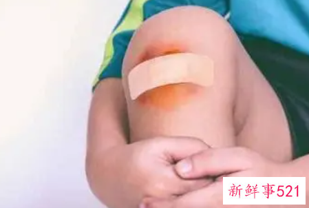 梦见摔伤有什么征兆