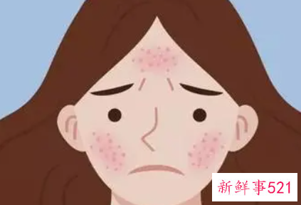 油性皮肤痘痘肌怎么调理