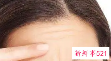 额头出现细纹按摩可以消除吗