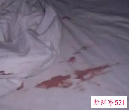 女人梦见自己吐好多血