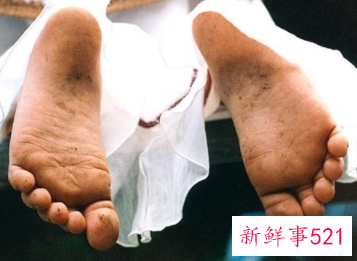 冬天脚出汗多是什么原因