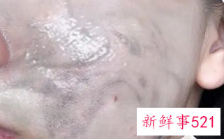 怎样才能深度清洁脸上的污垢