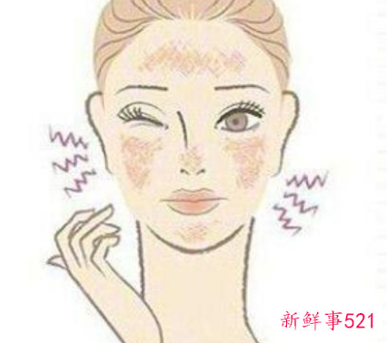 敏感性肌肤的主要特征及类型