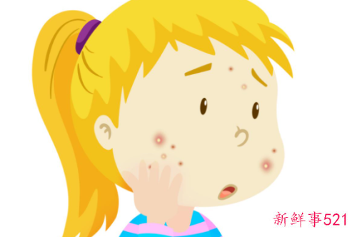 如何淡化黑色痘印