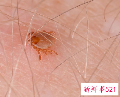 房间有小虫子怎么处理