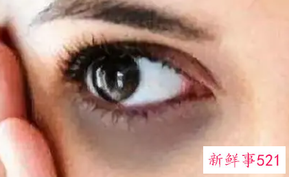 摆脱黑眼圈的方法