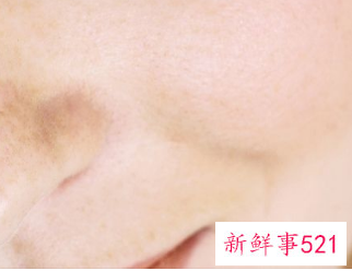 脸上起满了小米粒一样的疙瘩