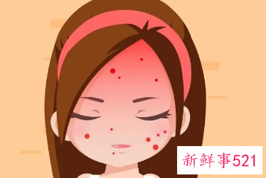 如何不用化妆品让皮肤变白