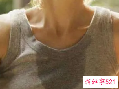 出汗为什么头部出汗多