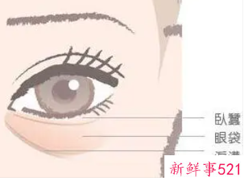 女人泪沟的处理方法