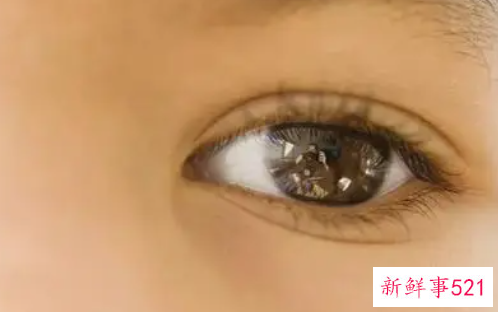 眼睛神经发育不好怎么办