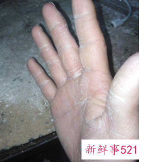 突然干活手变粗糙了怎么办