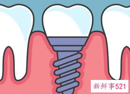 梦见满口牙掉吐在手上有血