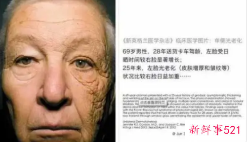 皮肤出现严重衰老的原因