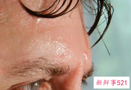出汗为什么头部出汗多