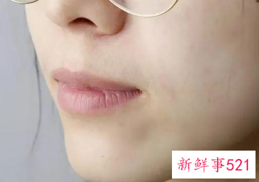 女生如何减少小胡子