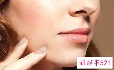 眼袋部位有脂肪粒是怎么回事