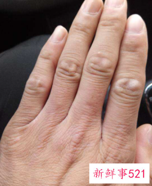 突然干活手变粗糙了怎么办