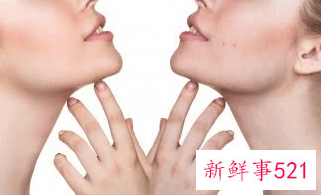 脸上脱皮干燥紧绷刺痛发红可以用芦荟胶吗