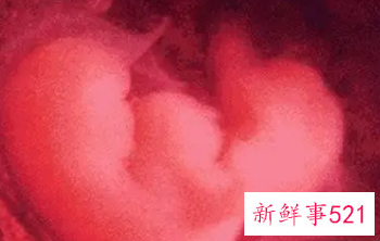 怀孕一周有什么症状