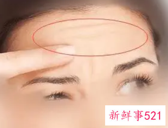 去除抬头纹小妙招