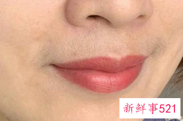 女生如何减少小胡子