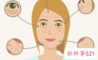 脸颊两边有黑色素块是什么原因